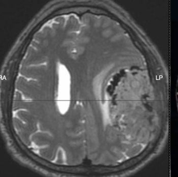 Dr. Sergio Ramírez Aragón