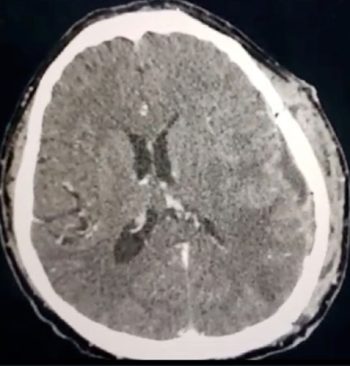 Dr. Sergio Ramírez Aragón